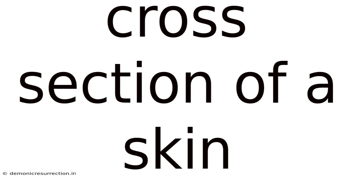 Cross Section Of A Skin