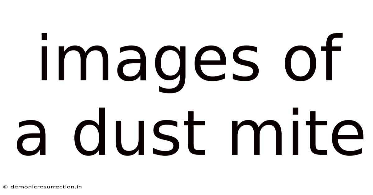 Images Of A Dust Mite