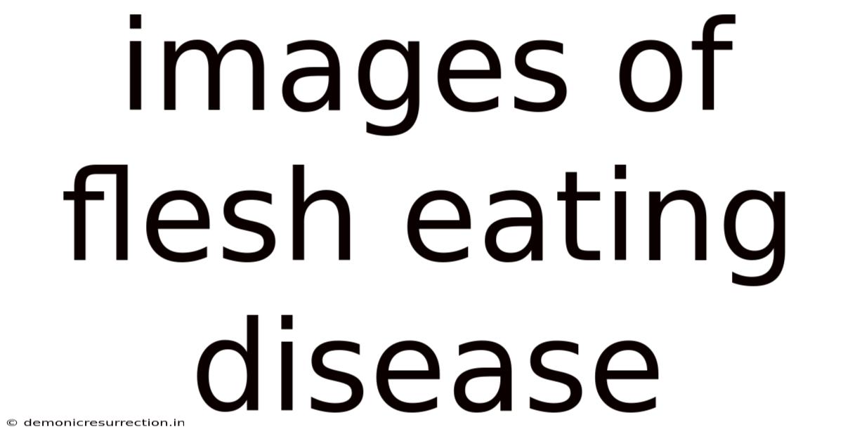 Images Of Flesh Eating Disease