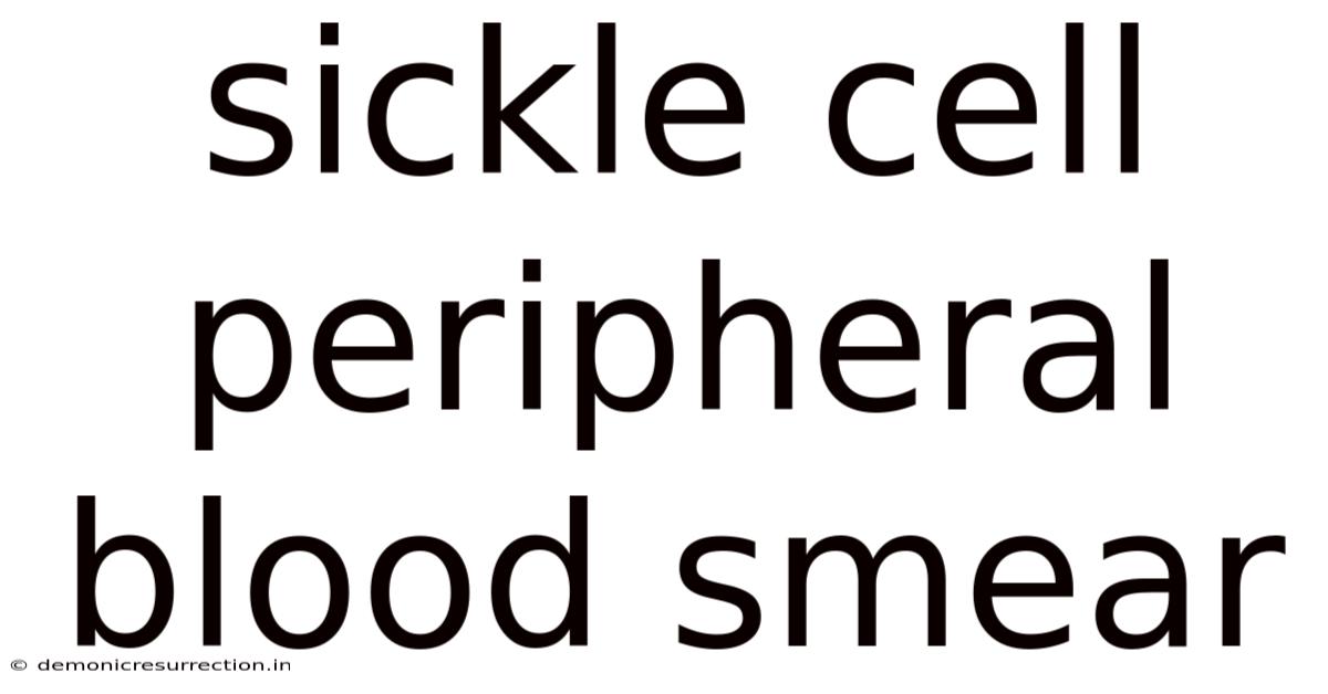 Sickle Cell Peripheral Blood Smear