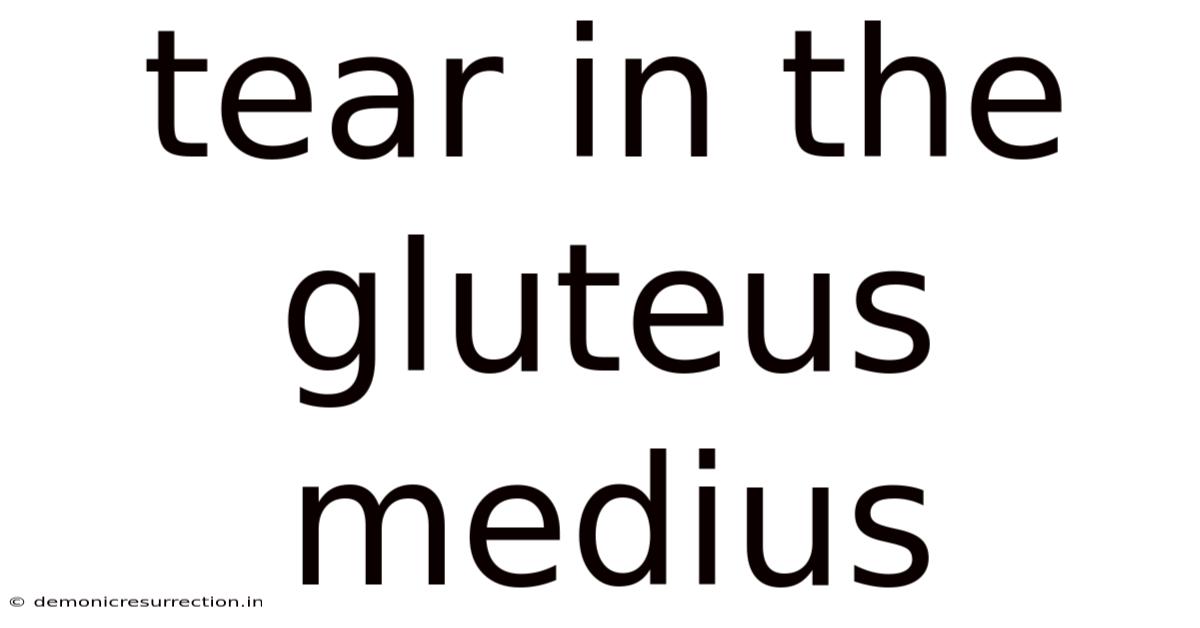 Tear In The Gluteus Medius