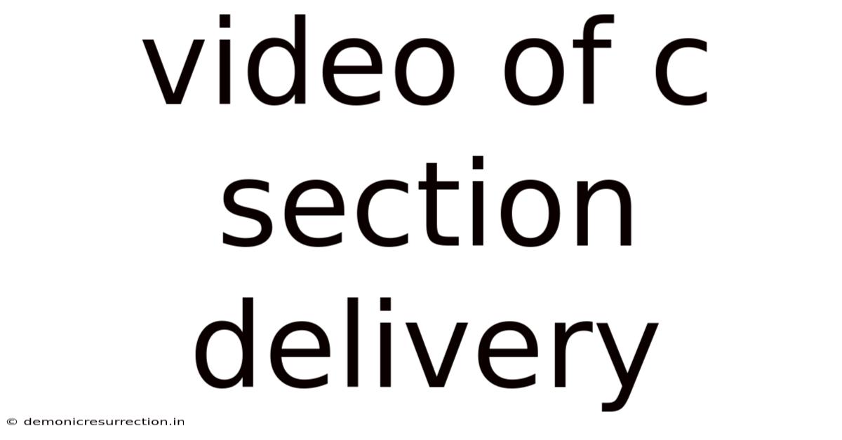 Video Of C Section Delivery